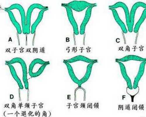 <b>输卵管堵塞，高龄生子、染色体易位！试管成功案例~试管代妈qq群</b>